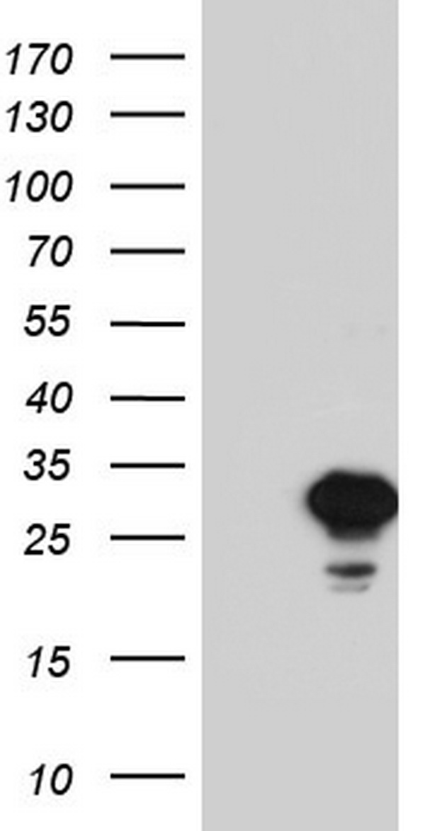 HEK293T cells were transfected with the pCMV6-ENTRY control (Left lane) or pCMV6-ENTRY SPA17 (Right lane) cDNA for 48 hrs and lysed. Equivalent amounts of cell lysates (5 ug per lane) were separated by SDS-PAGE and immunoblotted with anti-SPA17.