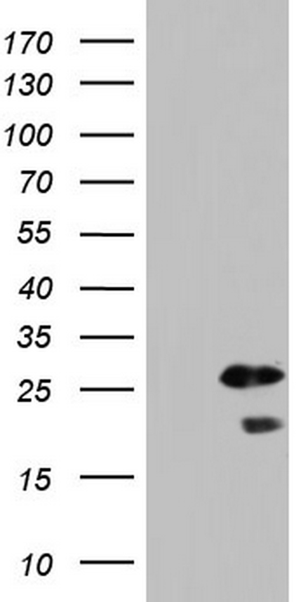 HEK293T cells were transfected with the pCMV6-ENTRY control (Left lane) or pCMV6-ENTRY SPA17 (Right lane) cDNA for 48 hrs and lysed. Equivalent amounts of cell lysates (5 ug per lane) were separated by SDS-PAGE and immunoblotted with anti-SPA17.