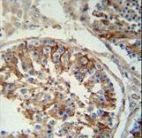 SACA1 antibody immunohistochemistry of formalin-fixed and paraffin-embedded human testis tissue followed by peroxidase-conjugated secondary antibody and DAB staining.