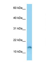 SPACA4 antibody LS-C146219 Western blot of Jurkat Cell lysate. Antibody concentration 1 ug/ml.