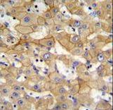 SPACA5 Antibody immunohistochemistry of formalin-fixed and paraffin-embedded human liver tissue followed by peroxidase-conjugated secondary antibody and DAB staining.
