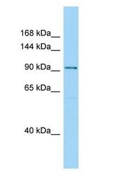 SPAG1 / TPIS antibody Western Blot of Fetal kidney.