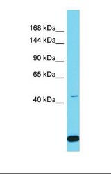 Western blot of Human MCF7. SPAG1 antibody dilution 1.0 ug/ml.