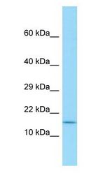 SPAG11A antibody Western Blot of HCT15.