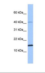 Fetal muscle lysate. Antibody concentration: 1.0 ug/ml. Gel concentration: 10-20%.