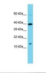 Western blot of Human Large Intestine Tumor. SPAG11B antibody dilution 1.0 ug/ml.