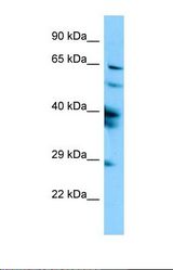 Western blot of Human HepG2. SPAG16 antibody dilution 1.0 ug/ml.