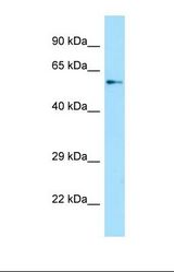 Western blot of Human HepG2. SPAG16 antibody dilution 1.0 ug/ml.