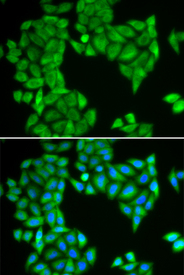 Immunofluorescence analysis of HeLa cell using SPAG5 antibody. Blue: DAPI for nuclear staining.