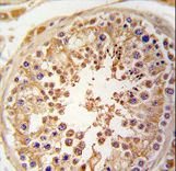 Formalin-fixed and paraffin-embedded human testis tissue reacted with SPAG9 antibody , which was peroxidase-conjugated to the secondary antibody, followed by DAB staining. This data demonstrates the use of this antibody for immunohistochemistry; clinical relevance has not been evaluated.