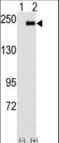 Western blot of SPAG9(arrow) using rabbit polyclonal SPAG9 Antibody. 293 cell lysates (2 ug/lane) either nontransfected (Lane 1) or transiently transfected with the SPAG9 gene (Lane 2) (Origene Technologies).