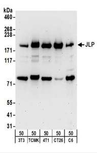 Detection of Mouse and Rat JLP by Western Blot. Samples: Whole cell lysate (50 ug) from NIH3T3, TCMK-1, 4T1, CT26.WT, and rat C6 cells. Antibodies: Affinity purified rabbit anti-JLP antibody used for WB at 1 ug/ml. Detection: Chemiluminescence with an exposure time of 3 minutes.