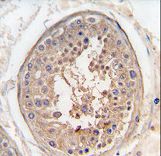 Formalin-fixed and paraffin-embedded human testis tissue reacted with SPAG9 antibody , which was peroxidase-conjugated to the secondary antibody, followed by DAB staining. This data demonstrates the use of this antibody for immunohistochemistry; clinical relevance has not been evaluated.