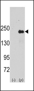 Western blot of SPAG9 (arrow) using rabbit polyclonal SPAG9 Antibody. 293 cell lysates (2 ug/lane) either nontransfected (Lane 1) or transiently transfected with the SPAG9 gene (Lane 2) (Origene Technologies).