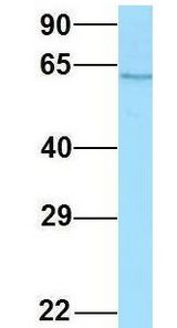 SPAM1 / PH20 antibody Western Blot of Human Placenta. Antibody Dilution: 1.0ug/ml. Antibody dilution: 1 ug/ml.