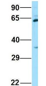 SPAM1 / PH20 antibody Western Blot of 293T lysate. Antibody Dilution: 1.0 ug/ml. Antibody dilution: 1 ug/ml.