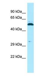 SPAM1 / PH20 antibody Western Blot of Jurkat.