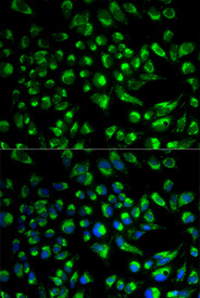 Immunofluorescence analysis of HeLa cell using SPAM1 antibody. Blue: DAPI for nuclear staining.