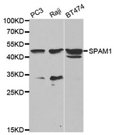 Western blot analysis of extracts of various cell lines, using SPAM1 antibody.