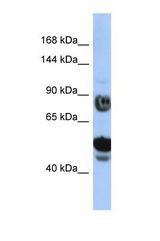 Western blot of Human HepG2. ZFYVE26 antibody dilution 1.0 ug/ml.