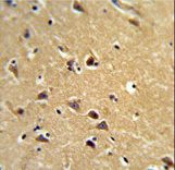 Formalin-fixed and paraffin-embedded human brain tissue reacted with SPG20 Antibody , which was peroxidase-conjugated to the secondary antibody, followed by DAB staining. This data demonstrates the use of this antibody for immunohistochemistry; clinical relevance has not been evaluated.