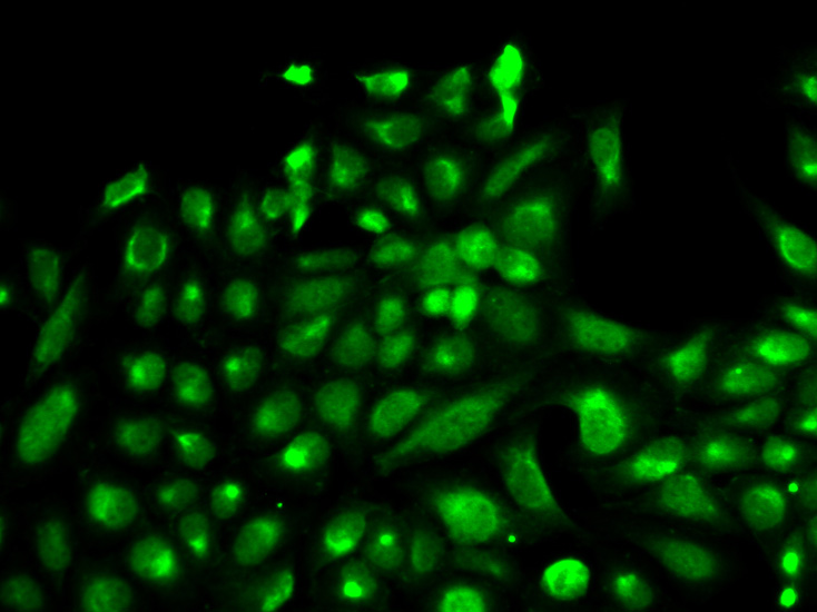 Immunofluorescence analysis of HeLa cell using SPHK1 antibody.