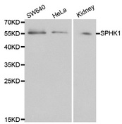 Western blot analysis of extracts of various cell lines, using SPHK1 antibody.