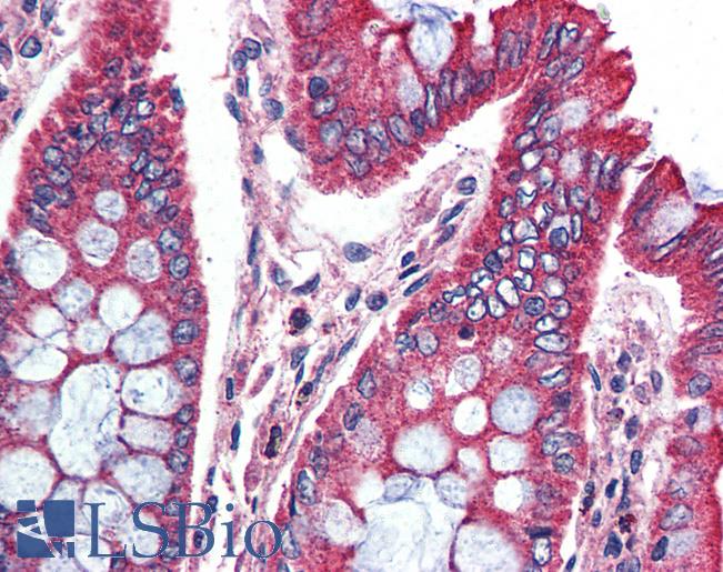 Anti-SPHK1 antibody LS-A3104 IHC of human colon. Immunohistochemistry of formalin-fixed, paraffin-embedded tissue after heat-induced antigen retrieval.