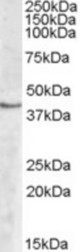 Antibody (2 ug/ml) staining of Human Peripheral Blood Mononucleocyte lysate (35 ug protein in RIPA buffer). Primary incubation was 1 hour. Detected by chemiluminescence
