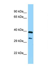SPHK1 antibody LS-C146131 Western blot of Fetal Lung lysate. Antibody concentration 1 ug/ml.