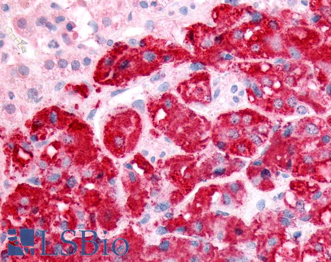 Anti-SPHK1 antibody LS-A3106 IHC of human adrenal, pheochromocytes. Immunohistochemistry of formalin-fixed, paraffin-embedded tissue after heat-induced antigen retrieval.