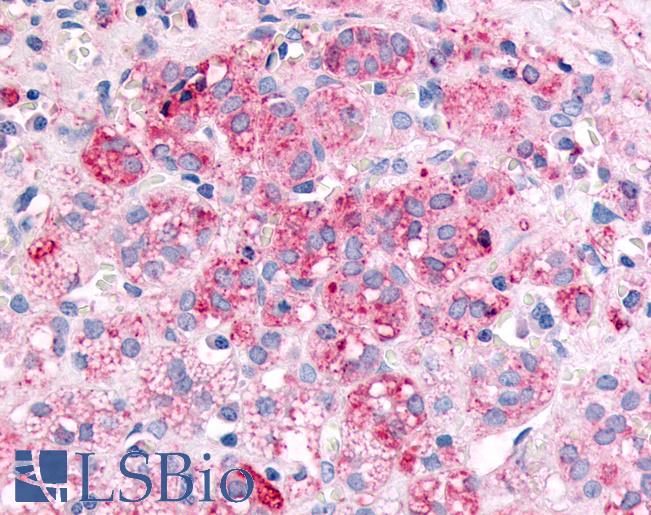 Anti-SPHK1 antibody LS-A3102 IHC of human adrenal, zona glomerulosa. Immunohistochemistry of formalin-fixed, paraffin-embedded tissue after heat-induced antigen retrieval.