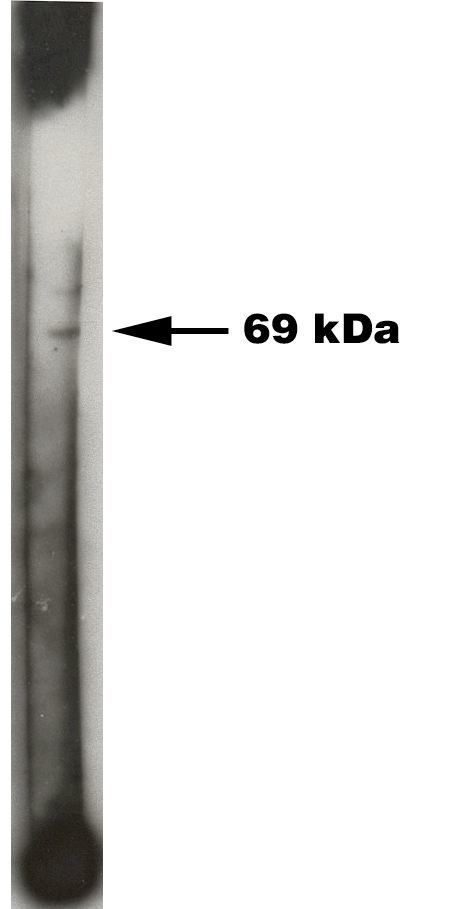 Western blot of Sphingosine Kinase 2 antibody on 50 ng of recombinant Sphinogsine Kinase 2 enzyme. Antibody used at 1:200 dilution. Visualized using Pierce West Femto substrate system. Secondary used at 1:30k dilution. Exposure for 45 seconds.