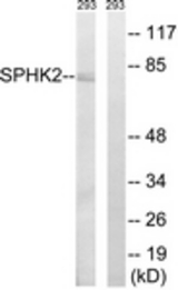 Western blot of extracts from 293 cells, using SPHK2 (Ab-614) Antibody. The lane on the right is treated with the synthesized peptide.