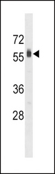 SPHK2 Antibody (A605) western blot of HepG2 cell line lysates (35 ug/lane). The SPHK2 antibody detected the SPHK2 protein (arrow).