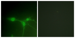 Immunofluorescence of NIH-3T3 cells, using Breast Tumor Kinase (Ab-447) Antibody. The picture on the right is treated with the synthesized peptide.