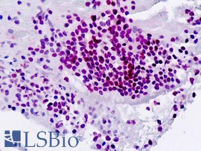 Anti-SPI1 / PU.1 antibody IHC staining of human spleen. Immunohistochemistry of formalin-fixed, paraffin-embedded tissue after heat-induced antigen retrieval.