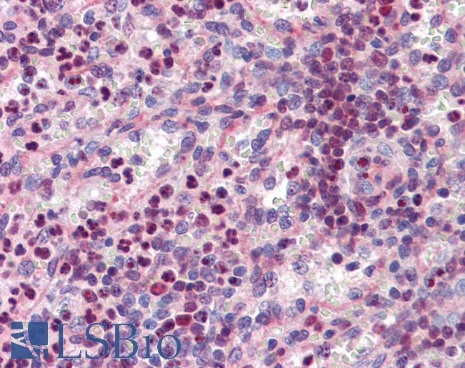 Anti-SPI1 / PU.1 antibody IHC of human spleen. Immunohistochemistry of formalin-fixed, paraffin-embedded tissue after heat-induced antigen retrieval. Antibody LS-B3822 concentration 3.75 ug/ml.