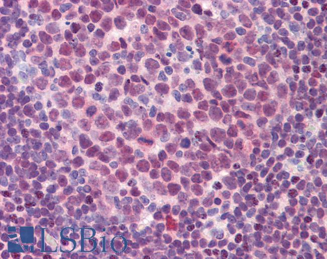 Anti-SPI1 / PU.1 antibody IHC of human colon, lymphoid aggregate. Immunohistochemistry of formalin-fixed, paraffin-embedded tissue after heat-induced antigen retrieval. Antibody LS-B3822 concentration 3.75 ug/ml.