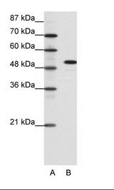 A: Marker, B: Daudi Cell Lysate