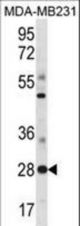 SPIB Antibody western blot of MDA-MB231 cell line lysates (35 ug/lane). The SPIB antibody detected the SPIB protein (arrow).