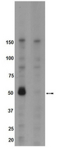 WB: IGF-1 stimulated lysates from 293T cells transfected with Brk (Lane1) and mutant Brk (Y342A) (lane2) were resolved by electrophoresis, transferred to PVDF, and probed with anti-phospho Brk(Y342) for 2 hours at room temperature. Proteins were visualized via HRP and chemiluminescent detection. Arrow indicates phospho-Brk(Y342).