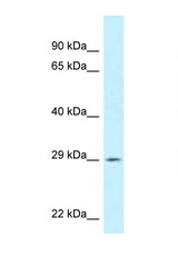 SPIC antibody LS-C145753 Western blot of ACHN Cell lysate. Antibody concentration 1 ug/ml.