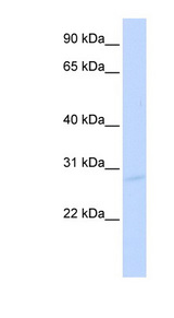 SPIC antibody LS-C110452 Western blot of Transfected 293T cell lysate.