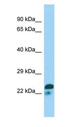 SPIN2A antibody Western Blot of Jurkat.
