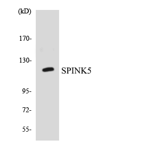 Western blot of the lysates from COLO205 cells using SPINK5 antibody.