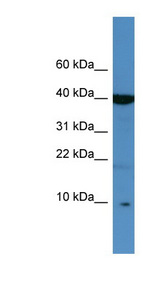 SPINK6 antibody LS-C135365 Western blot of Jurkat lysate.