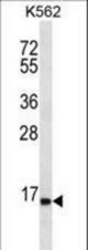 SPINK8 Antibody western blot of K562 cell line lysates (35 ug/lane). The SPINK8 antibody detected the SPINK8 protein (arrow).