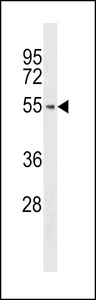Western blot of anti-hPTK6-E26 antibody in A375 cell line lysate (35 ug/lane). hPTK6-E26(arrow) was detected using the purified antibody.