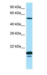 SPINT1 / HAI-1 antibody Western Blot of PANC1.